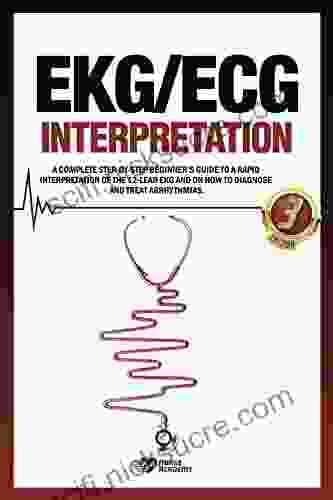 EKG/ECG Interpretation: A complete step by step beginner s guide to a rapid interpretation of the 12 lead EKG and on how to diagnose and treat arrhythmias